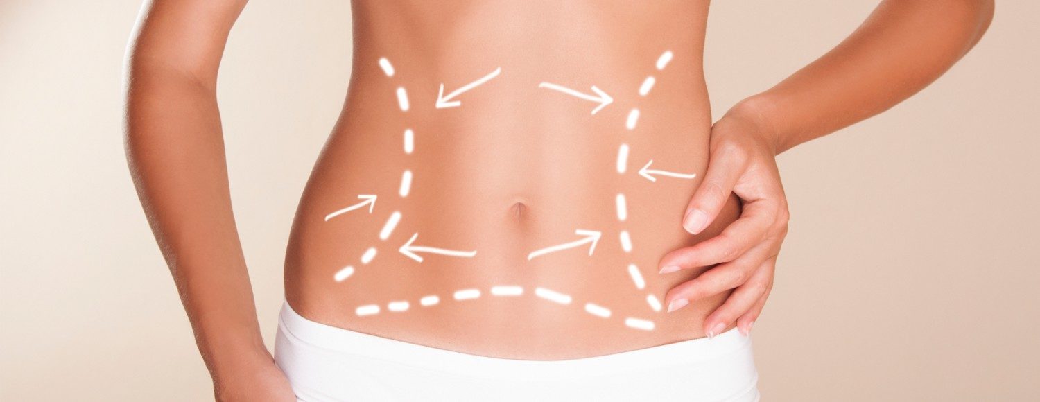 Body Contouring Surgery