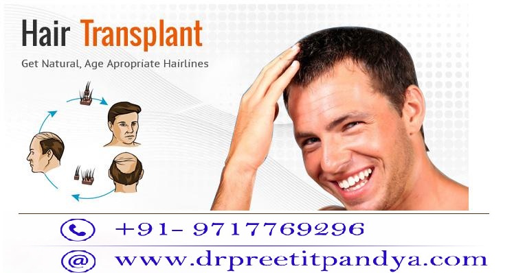 hair transplant surgery