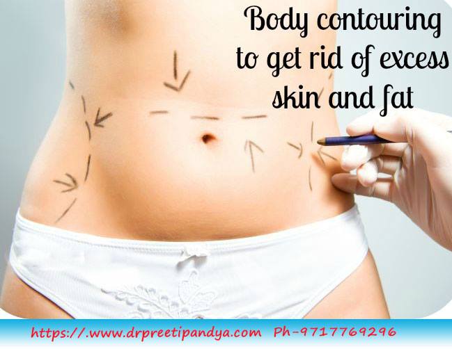 body Contouring surgery