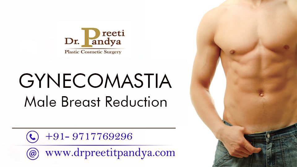 gynecomastia surgery, male breast reduction surgery, gynecomastia surgeon