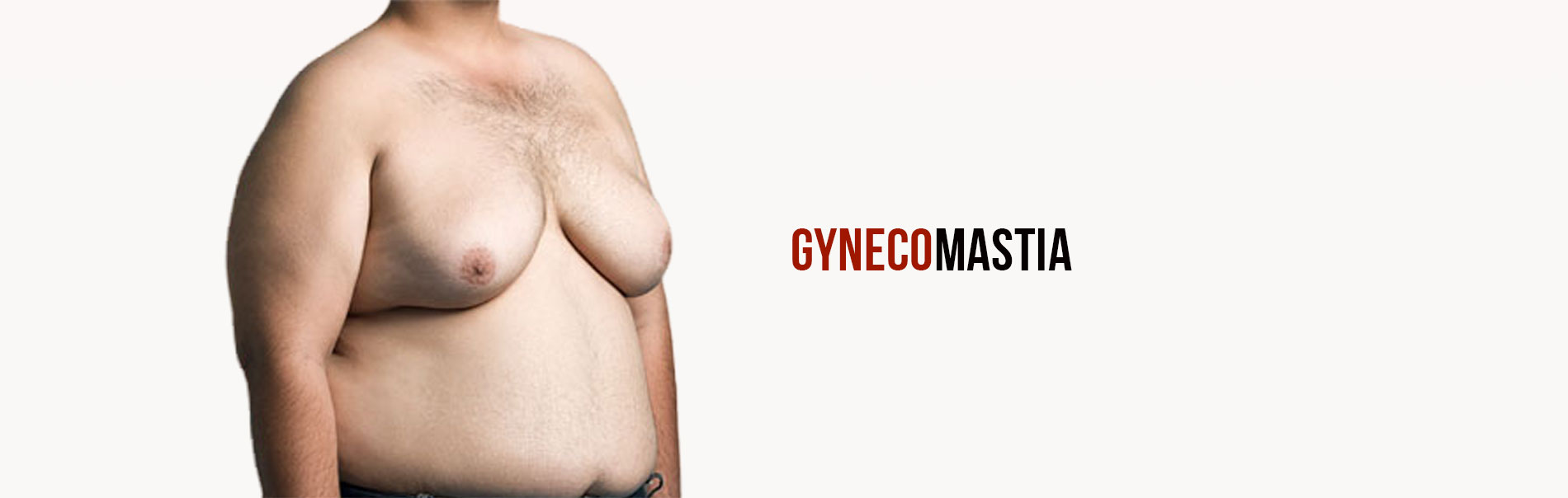 gynecomastia surgery